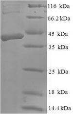 Greater than 90% as determined by SDS-PAGE.Recombinant Human Dickkopf-Related Protein 2 (DKK2) Protein (His-SUMO)