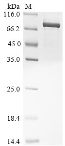 Greater than 85% as determined by SDS-PAGE.Recombinant Human Poly [Adp-Ribose] Polymerase 2 (PARP2) Protein (His)