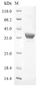 Greater than 85% as determined by SDS-PAGE.Recombinant Human Poly [Adp-Ribose] Polymerase 2 (PARP2) Protein (His)