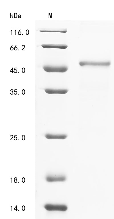 Greater than 90% as determined by SDS-PAGE.Recombinant Human Chordin-Like Protein 1 (CHRDL1) Protein (His-GST&Myc)