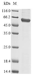 Greater than 85% as determined by SDS-PAGE.Recombinant Human E3 Ubiquitin-Protein Ligase Traip (TRAIP) Protein (His)