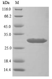 Greater than 85% as determined by SDS-PAGE.Recombinant Mouse Sclerostin Domain-Containing Protein 1 (SOSTDC1) Protein (His&Myc)