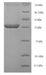 Greater than 90% as determined by SDS-PAGE.Recombinant Human Phospholysine Phosphohistidine Inorganic Pyrophosphate Phosphatase (LHPP) Protein (His-SUMO)