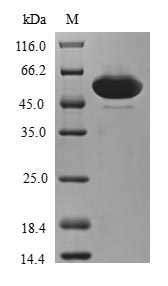 Greater than 90% as determined by SDS-PAGE.Recombinant Human An1-Type Zinc Finger Protein 3 (ZFAND3) Protein (GST)