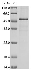 Greater than 85% as determined by SDS-PAGE.Recombinant Human Prolactin Regulatory Element-Binding Protein (PREB) Protein (His&Myc)