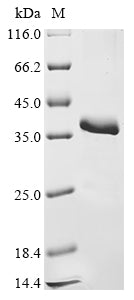 Greater than 90% as determined by SDS-PAGE.Recombinant Mouse Metalloproteinase Inhibitor 4 (TIMP4) Protein (His-SUMO)