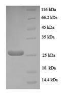 Greater than 90% as determined by SDS-PAGE.Recombinant Human Neuritin (NRN1) Protein (His-SUMO)