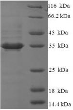 Greater than 90% as determined by SDS-PAGE.Recombinant Human Glutaminyl-Peptide Cyclotransferase-Like Protein (QPCTL) Protein (His-SUMO)