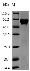 Greater than 90% as determined by SDS-PAGE.Recombinant Agrobacterium Sp. 3-Phosphoshikimate 1-Carboxyvinyltransferase (AROA) Protein (His-SUMO)