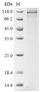 Greater than 85% as determined by SDS-PAGE.Recombinant Human Peroxisome Proliferator-Activated Receptor Gamma Coactivator 1-Alpha (PPARGC1A)