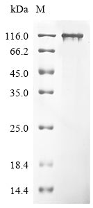 Greater than 90% as determined by SDS-PAGE.Recombinant Human Peroxisome Proliferator-Activated Receptor Gamma Coactivator 1-Alpha (PPARGC1A) Protein (His)