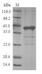 Greater than 90% as determined by SDS-PAGE.Recombinant Human Appetite-Regulating Hormone (GHRL) Protein (GST)