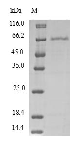 Greater than 90% as determined by SDS-PAGE.Recombinant Human Programmed Cell Death Protein 2-Like (PDCD2L) Protein (GST)