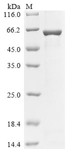 Greater than 85% as determined by SDS-PAGE.Recombinant Human E3 Ubiquitin-Protein Ligase Trim7 (TRIM7) Protein (His&Myc)