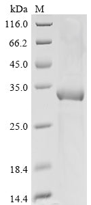 Greater than 85% as determined by SDS-PAGE.Recombinant Mouse Protein Il-40 Protein (His&Myc)