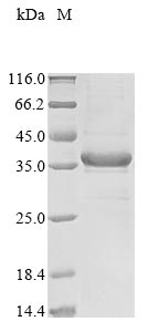 Greater than 85% as determined by SDS-PAGE.Recombinant Mouse Putative L-Aspartate Dehydrogenase (ASPDH) Protein (His&Myc)