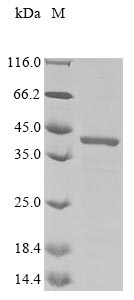 Greater than 85% as determined by SDS-PAGE.Recombinant Human Golgi Phosphoprotein 3 (GOLPH3) Protein (His)