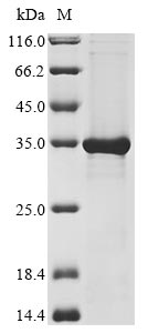 Greater than 85% as determined by SDS-PAGE.Recombinant Human F-Box Only Protein 44 (FBXO44) Protein (His&Myc)