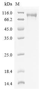 Greater than 90% as determined by SDS-PAGE.Recombinant Human Band 4.1-Like Protein 5 (EPB41L5) Protein (His&Myc)