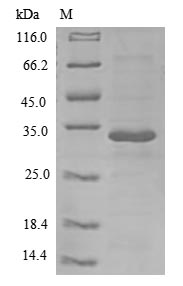 Greater than 85% as determined by SDS-PAGE.Recombinant Human Interleukin-26 (IL26) Protein (His-B2M)
