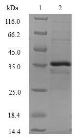 Greater than 90% as determined by SDS-PAGE.Recombinant Human Beta-Catenin-Interacting Protein 1 (CTNNBIP1) Protein (GST)