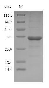 Greater than 90% as determined by SDS-PAGE.Recombinant Human Odorant-Binding Protein 2A (OBP2A) Protein (His-SUMO)