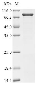 Greater than 85% as determined by SDS-PAGE.Recombinant Human Junctional Protein Associated With Coronary Artery Disease (JCAD) Protein (His)