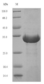 Greater than 90% as determined by SDS-PAGE.Recombinant Euroglyphus Maynei Mite Group 2 Allergen Eur M 2 (EURM2) Protein (His-SUMO)
