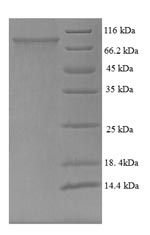 Greater than 90% as determined by SDS-PAGE.Recombinant Human Trichoplein Keratin Filament-Binding Protein (TCHP) Protein (His-SUMO)
