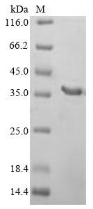 Greater than 90% as determined by SDS-PAGE.Recombinant Human Protein C1Orf43 (C1ORF43) Protein (His&Myc)
