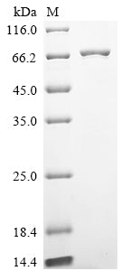 Greater than 85% as determined by SDS-PAGE.Recombinant Human Ubiquitin Carboxyl-Terminal Hydrolase 26 (USP26) Protein (His), Active