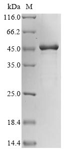 Greater than 85% as determined by SDS-PAGE.Recombinant Human Putative Beta-Actin-Like Protein 3 (POTEKP) Protein (His&Myc)