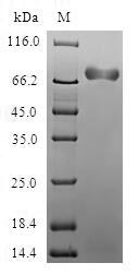 Greater than 90% as determined by SDS-PAGE.Recombinant Human Acidic Mammalian Chitinase (CHIA) Protein (GST)