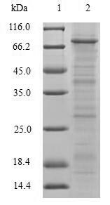 Greater than 90% as determined by SDS-PAGE.Recombinant Human Tripartite Motif-Containing Protein 5 (TRIM5) Protein (His-B2M)