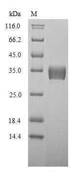 Greater than 90% as determined by SDS-PAGE.Recombinant Mouse 14-3-3 Protein Beta/Alpha (YWHAB) Protein (His)