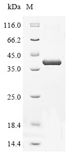 Greater than 90% as determined by SDS-PAGE.Recombinant Mouse Collagen Triple Helix Repeat-Containing Protein 1 (CTHRC1) Protein (His-SUMO)