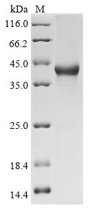Greater than 90% as determined by SDS-PAGE.Recombinant Human Sparc-Related Modular Calcium-Binding Protein 1 (SMOC1) Protein (His-GST)