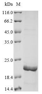 Greater than 85% as determined by SDS-PAGE.Recombinant Human Mucin-5B (MUC5B) Protein (His&Myc)