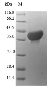 Greater than 90% as determined by SDS-PAGE.Recombinant Human Protein S100-A14 (S100A14) Protein (GST)