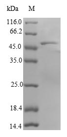 Greater than 90% as determined by SDS-PAGE.Recombinant Human Ras-Related Protein Rab-18 (RAB18) Protein (GST)