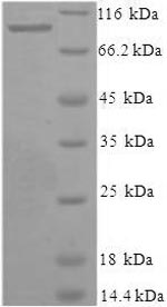Greater than 90% as determined by SDS-PAGE.Recombinant Human Xaa-Pro Aminopeptidase 1 (XPNPEP1) Protein (His-SUMO)