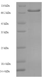 Greater than 90% as determined by SDS-PAGE.Recombinant Human Transmembrane Prolyl 4-Hydroxylase (P4HTM) Protein (His-SUMO)