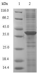 Greater than 90% as determined by SDS-PAGE.Recombinant Human Alpha-Hemoglobin-Stabilizing Protein (AHSP) Protein (GST)