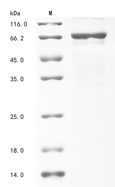 Greater than 85% as determined by SDS-PAGE.Recombinant Human Insulin-Like Growth Factor 2 Mrna-Binding Protein 1 (IGF2BP1) Protein (His&Myc)