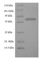 Greater than 90% as determined by SDS-PAGE.