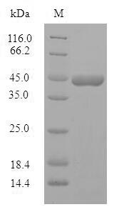 Greater than 90% as determined by SDS-PAGE.Recombinant Human Protein Phosphatase 1 Regulatory Subunit 1B (PPP1R1B) Protein (GST)