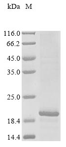 Greater than 85% as determined by SDS-PAGE.Recombinant Human Det1- And Ddb1-Associated Protein 1 (DDA1) Protein (His)