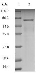 Greater than 90% as determined by SDS-PAGE.Recombinant Mouse Leucine-Rich Repeat And Immunoglobulin-Like Domain-Containing Nogo Receptor-Interacting Protein 1 (LINGO1) Protein (His)