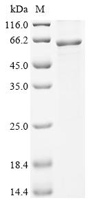Greater than 85% as determined by SDS-PAGE.Recombinant Human Thioredoxin-Interacting Protein (TXNIP) Protein (His-B2M)