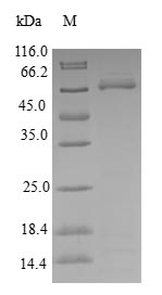 Greater than 90% as determined by SDS-PAGE.Recombinant Human Kinetochore-Associated Protein Dsn1 Homolog (DSN1) Protein (GST)